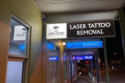 Laser-Tattoff - Tattoo Removal Photo